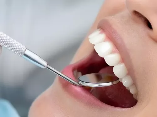 Prótesis dentales
