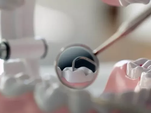 Odontología conservadora