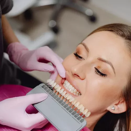 Blanqueamientos y estética dental